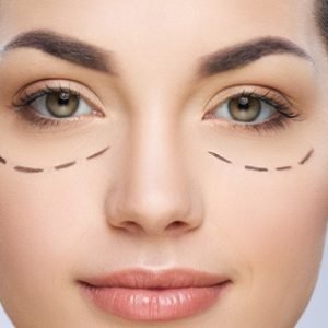Lifting ojos (50 min.)