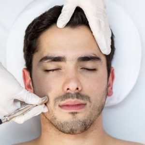 Microdermoabrasión (50 min.)